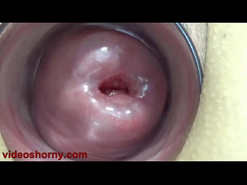 Cervix Fucking pumped uterus prolapsed and t.. b. a. pussy and tormented